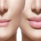 تكبيرالشفايف وتوريدهافي المنزل1_Androidswiki.net